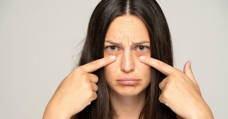 Як позбутися мішків під очима: рекомендації пластичного хірурга