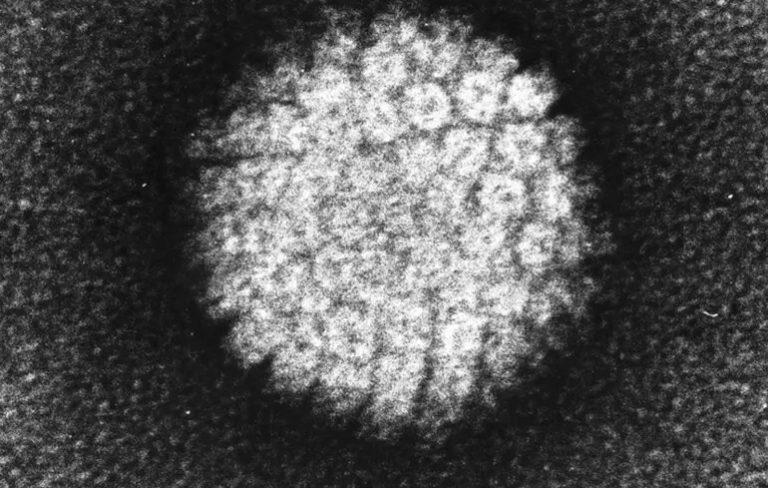 Крижана людина Етці виявилася носієм небезпечного вірусу